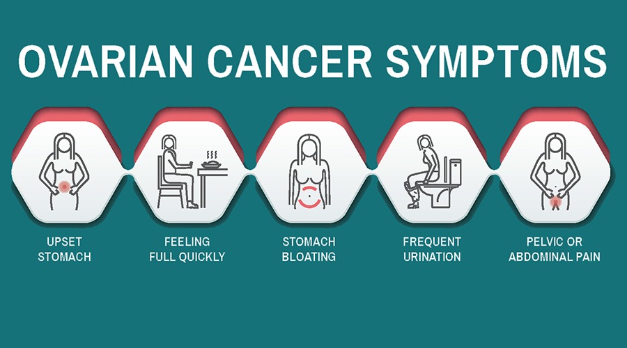 symptoms of ovarian cancer