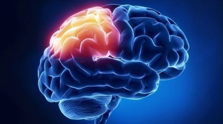 Brain Tumor