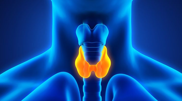 Thyroid Cancer