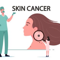 skin cancer ayurvedic treatment