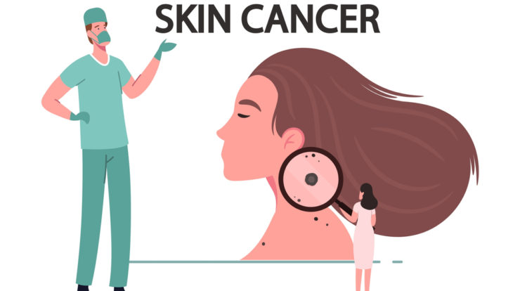 skin cancer ayurvedic treatment