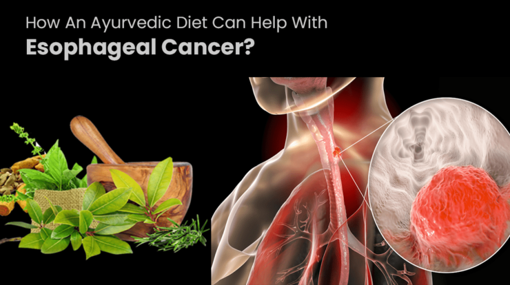 Ayurvedic diet for Esophageal Cancer