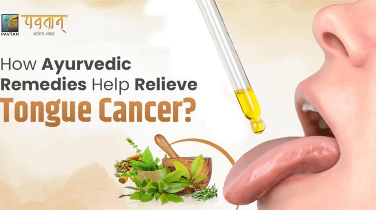 How Ayurvedic Remedies Help Relieve Tongue Cancer?