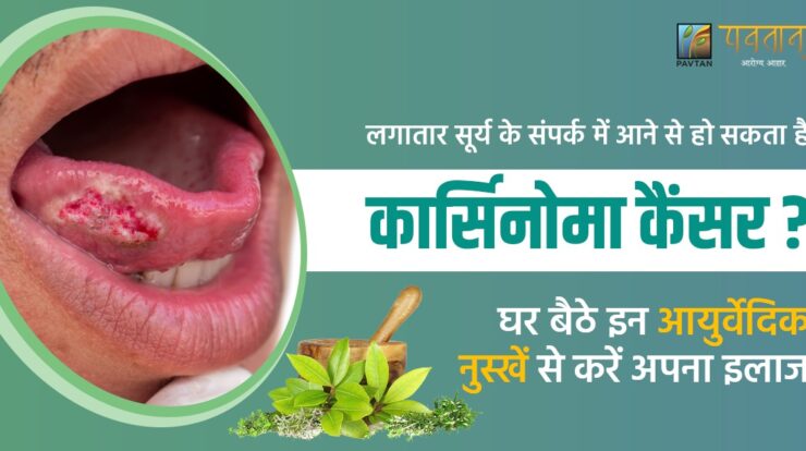 carcinoma cancer in hindi